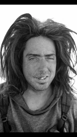 Homeless in LA - #homeless #man #la #santamonica #crazyhair #missingteeth #dirty #squinting #mattedhair #nikon #blackandwhite #streetphotography