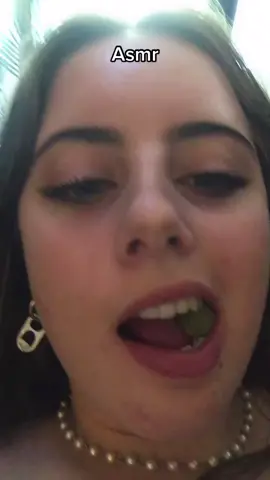 My acne is so bad lmao