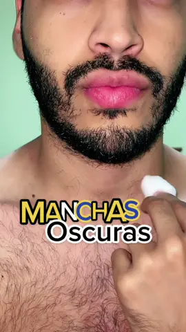 Oscurecimiento de la piel #tips #beauty #piel  #AprendeEnTikTok