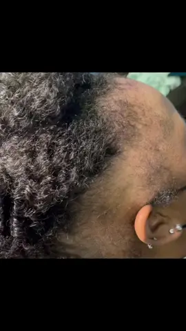 Alopecia Braider #memphis #atlanta #memphishairstylist #fyp