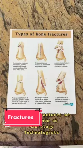 What do you think of these fractures? #TakeTheDayOffChallenge #radiologytechnologist #xraytechnologist #bones #fracture #radtechstudent #fyp #foryou