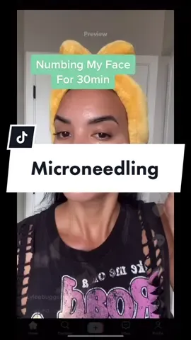 #drpen #microderm #skincaretips #skincaretip #skincareaesthetic #microneedledermaroller #microneedlebeforeandafter #athomeskincare #asmrskincare