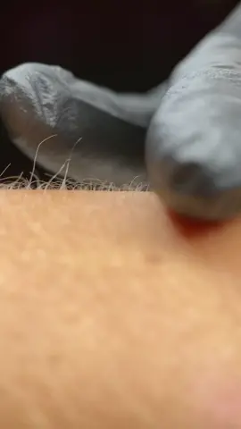 Ролик для рекламы лазерной эпиляции #laser #advertising