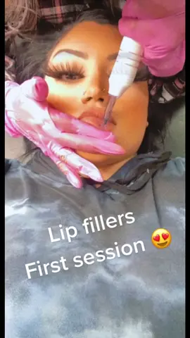 First seshhh 🤍 #lipfillers #lipfillercheck #fypシ #explor #SaveIt4TheEndZone #MakeADogsDay #IKnowWhatYouDid #myfinALLYmoment #TargetHalloween