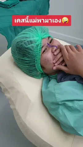 คุณแม่บ้านไหนเล็งๆไว้ ดูเคสนี้เลยค่าา 🤪 #หน้าตาที่เปลี่ยนไป #yd #คลินิกเสริมความงาม #ยองโดคลินิก #เสริมจมูก