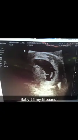 I would do it all over again… #babyboy #2monthsold #iloveyou #growingup #boymom #babytiktoker