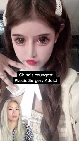 #plasticsurgery #plasticsurgeryjourney