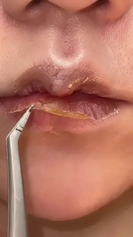 Lip mask peeling #lipbalm #lipstickchallenge #beauty #lipmask #lipstick #skincare