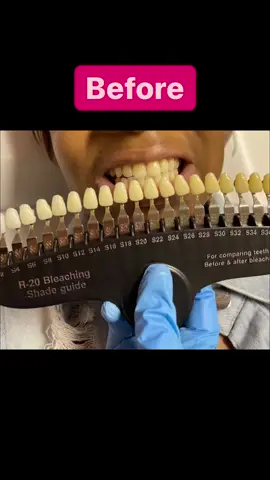 #houston #houstonteethwhitening #houstonbeauty #houstonluxury #modernbeautylounge