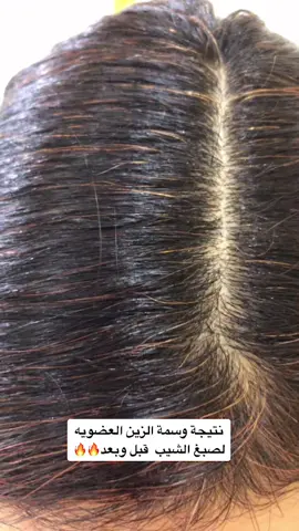 #fyp #عتيبه #اكسبلور #fypシ  #عتيبي  #expression