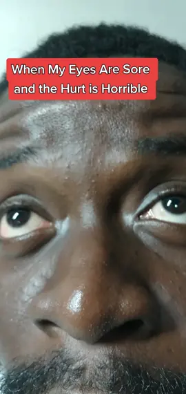 Horrible eye ache😭#thanksgiving