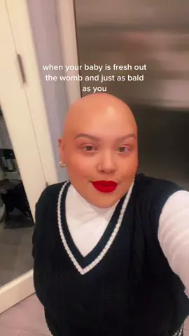 bald twins