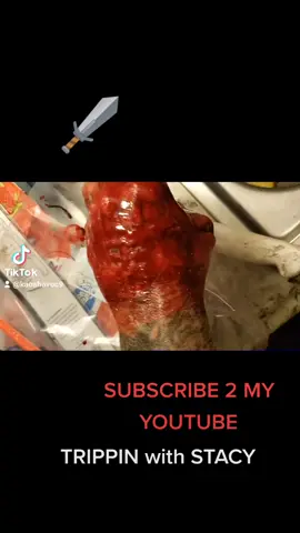 flesh wound #fyp #fypシ #AmazonMusicJingleBellTok #TheSplashDance #TRIPPINwithSTACY #Outdoors #tiktok #fail #cut #tendon #recovered #islandboy