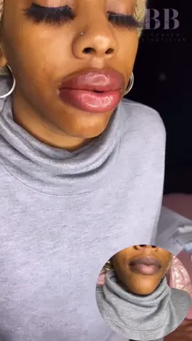 #stitch with @beautifiedbyjassiellc #greenscreen #MacysGiftTok #lipneutralization #lipfiller #fyp