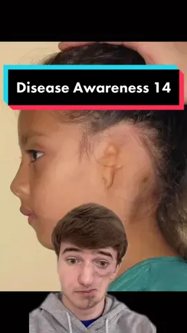 What disease should I cover next? 😁#tiktokforgood