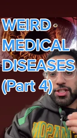 😳😰 #eyefacts #eyeparasite #parasite #weirddisease #medicalfact #tiktokdoctor #infection #eyeinfection #DoTheJuJu