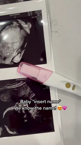 Baby girl ❤️ #baby #Love #babytest #babylove #babiesoftiktok #tiktokbabies #mommasoftiktok #wholesome #newbabygirl #cute #happy #foryoupage #fypシ