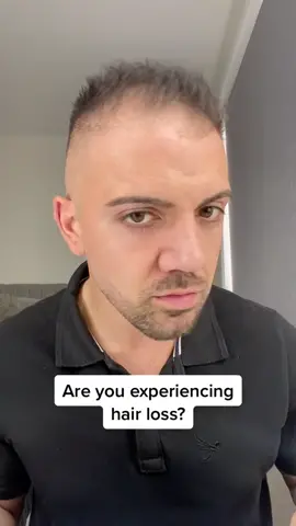 The more hair the better it gets #thickfiber #hairfibersformen #hairloss #thinninghair