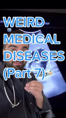 🤰🏻 #ectopic #ectopicpregnancy #pregnancyfact #humanbodyfact #tiktokdoctor #humanbody #liver #cashapp13plus