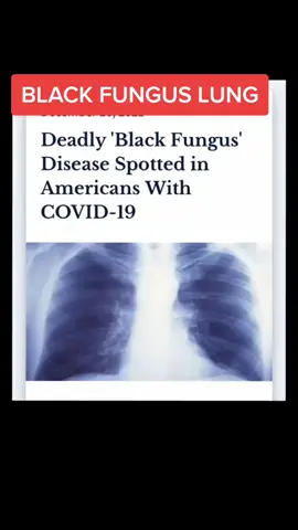 #stitch with @laughterinlight After filming this I realized it could also be Resident Evil 7. #covid #vaccine #infection #thelastofus #residentevil7