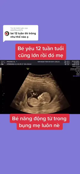 Trả lời @dyb21kxv2d7a  đây nha mom, bé lớn, hình ảnh rõ ràng rồi #lamme #mangthai #mom #beyeu #conyeu #babyplus #hibaby_hapi #trending #fyp