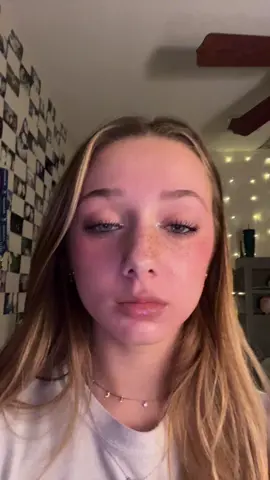 why does it make ur lips dirty