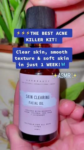 The kit that saved my ACNE!💗 #foryoupage #foryou #trending #skin #skincare #acne #acneskin #clearingacne #desi #asiangirl #punjabi