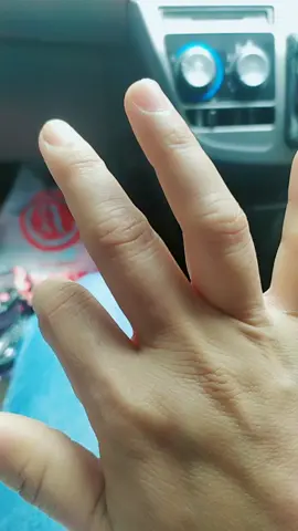 viti ga jelas#MissingHalf #TemanHealing #🤣🤣😂😂😂 #🙏🙏🙏🙏🙏🙏🙏🙏