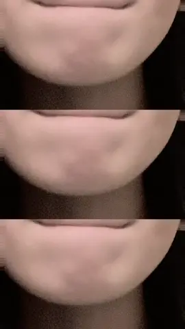 いいですかみなさんこれが八重歯です