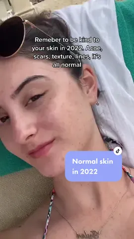 #normalskin #acneskin #texturedskin #acneconfidence #selflove #normalizenormalskin #acnecheck #acnescars #acnetips #acnehelp #acnepositivity #fy #2022