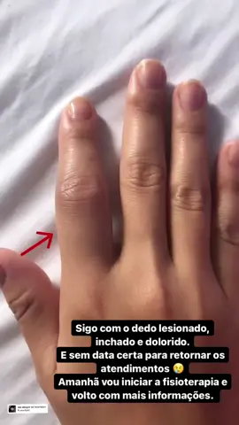Dedo lesionado há 10 dias😢 causado por movimentos repetitivos. #sobrancelha #amorpelaprofissao #sobrancelhasperfeitas #sobrancelhas #microblading