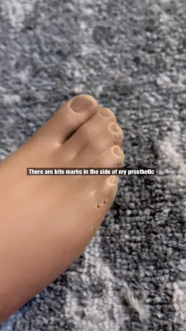 AGAIN!? 😆 #Oops #Puppy #Dog #Destruction #Foot #Leg #Prosthetic #ProstheticLeg