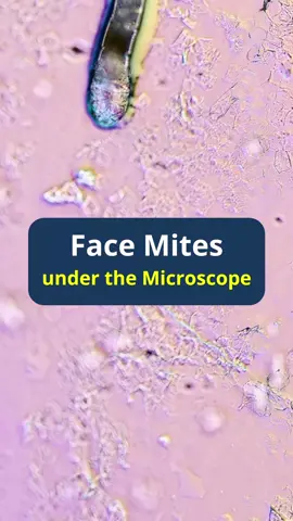 Demodex  Face Mites under the microscope. #facemites  #demodex #animal #parasite #microscope #microbehunter
