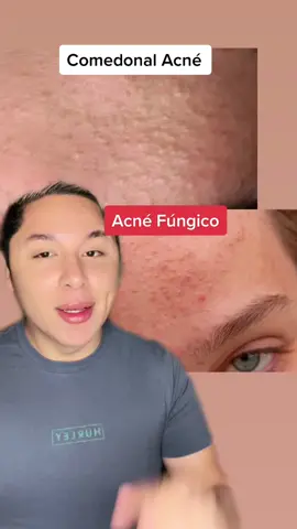 #fyp #skincare #selfcaretips #foryou #skin #cuidatupiel #cuidadodelapiel #pielbonita #pielsana #skintips #carloscervantes #piel #pielperfecta #acne #😇
