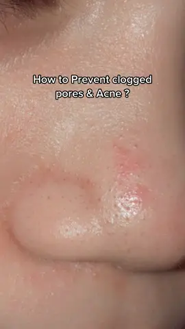 Stop using baby powder on your face! #dearfaceph #dearface