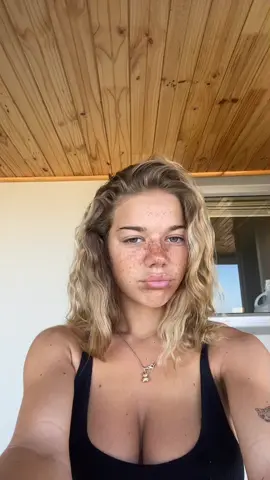 makes my real freckles look weak