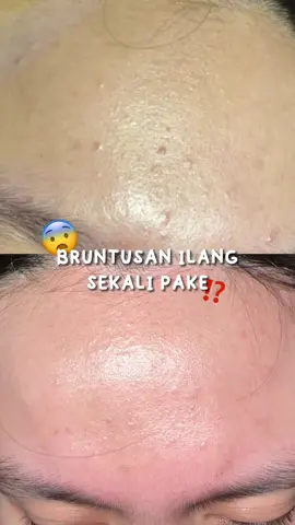 racun ka titan always valid🥲🤍 #kourubeauty #claymask #bruntusan