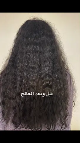 #بروتين_الشعر #fypシ #viral #اكسبلورر #اكسبلور_تيك_توك #ترند #جدة #بنات #بنات_جدة #for #الهاشتاقات_للرخوم #قبل_وبعد #xplore #بعد_البروتين #تريتمنت #برو