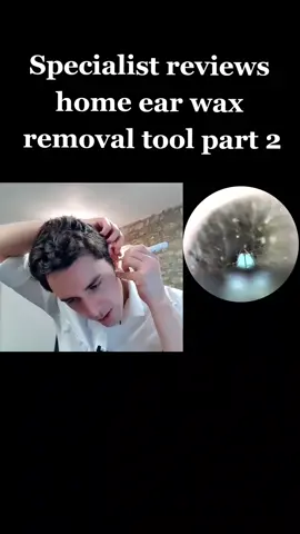 Specialist reviews home ear wax removal tool part 2 #durhamhearingspecialists #earwaxremoval #audiology #homeearwaxremoval #ears