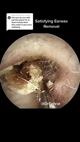 Reply to @braydon717 Earwax removal of the day #entdoctor #earcamera #earwaxremoval #medtok #medstudent #earwax #CloseYourRings