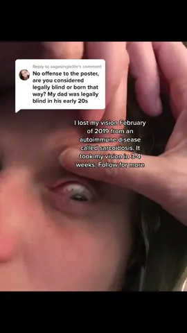 Reply to @sagasinglelife #sarcoidosis #sarcoidosiswarrior #blind #visuallyimpaired