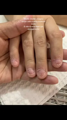 Amoo #unhas #unhasdegel #unha