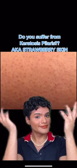 #ad How to prevent 🍓skin with @First Aid Beauty #firstaidbeauty #TikTokMadeMeBuyIt #tiktokmademebuyFAB #strawberryskin