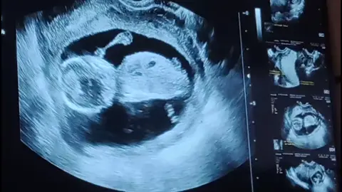3months 🤰Ultrasound 😇😊