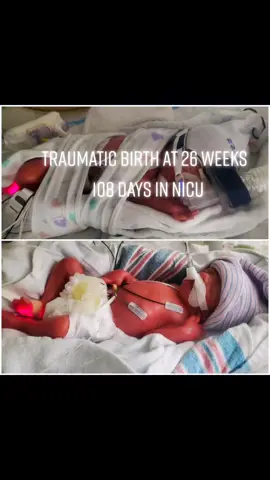 My miracle boys #twinmom #nicubaby #nicustrong #preemie #MACChallengeAccepted #BbStyleFearlessly #fypシ