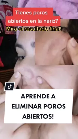 Elimina la apariencia de poros ABIERTOS #cuidadodelapiel #porosabiertos #pielgrasa #puntosnegros #pieloleosa #skincare #pielsana #mamaemprendedora