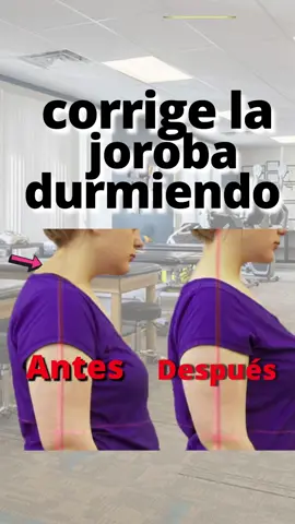 corrige la joroba al dormir #joroba #malapostura #jorobadecuello #cabezaadelantada #fisioterapia #AprendeConTikTok