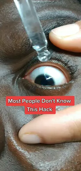 Did you know this hack 😳#eyes#allergies#eliyahmashiach#learnfromeliyahmashiach#fyp