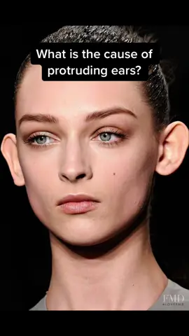Do you know what is the cause of protruding ears? #protrudingears #bigears #bigear #fyp