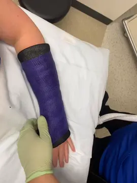 Take it offfffff!!!!!! #orthofelipe #felipethetaco #orthopedics #castsaw #MaiselChalleng  #MakeItGucci #fyp